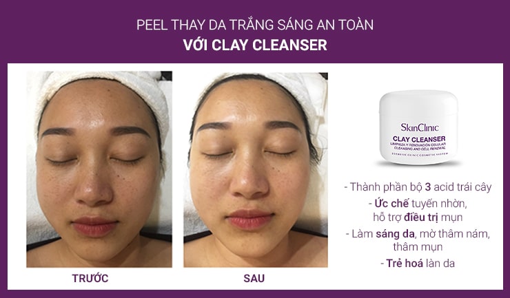 SkinClinic Clay Cleanser - Belle Lab 