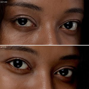 FOREO IRIS 2 Eye Massager giúp cải thiện vùng da quanh mắt